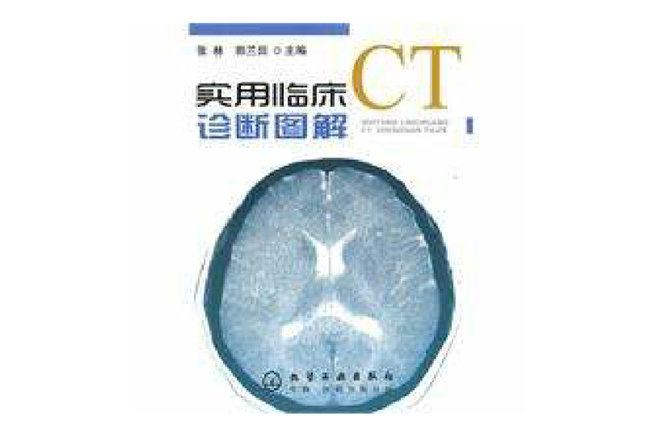 实用临床CT诊断图解