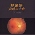 眼底病诊断与治疗