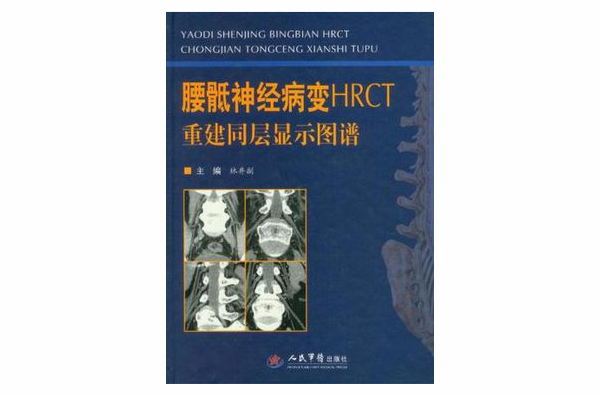 腰骶神经病变HRCT重建同层显示图谱