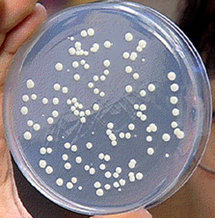 用于分离微生物的固体培养基 用于分离微生物的固体培养基
