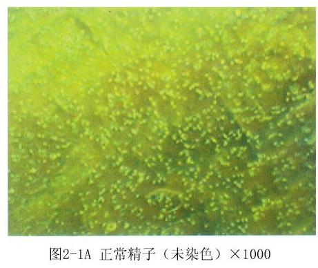 人类正常的精子 人类正常的精子