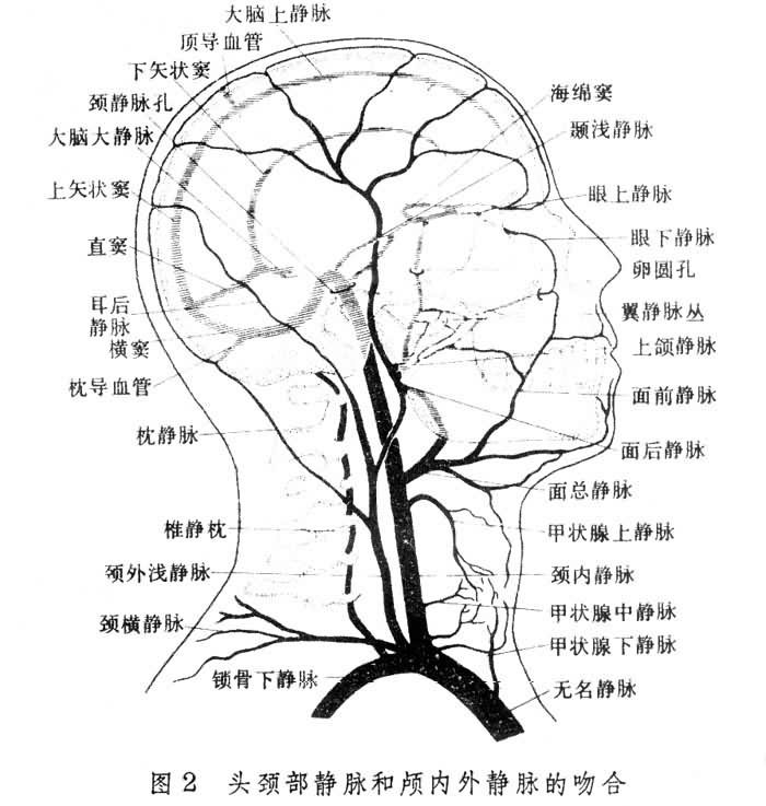 脑循环示意图2 脑循环示意图2