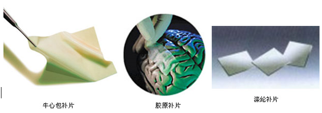 人工硬脑膜 人工硬脑膜