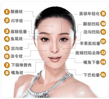 面部除皱 面部除皱