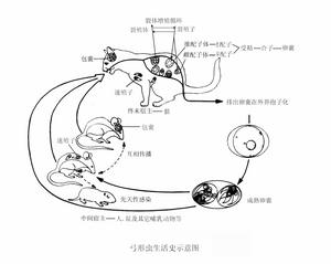 获得性弓形虫病 获得性弓形虫病