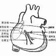 应激综合症