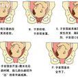 产程