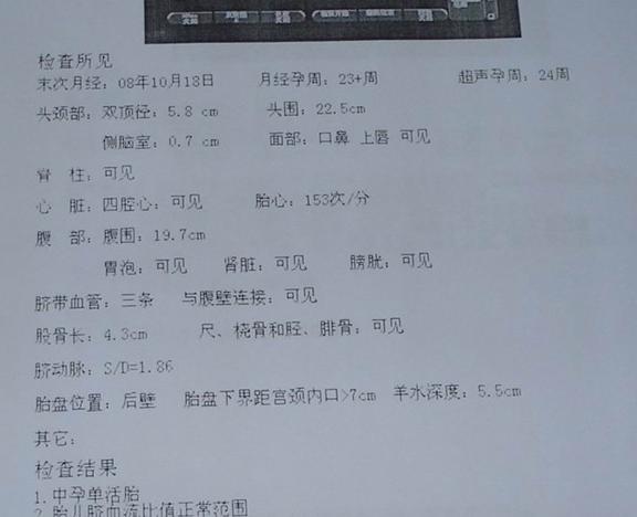 糖筛 糖筛