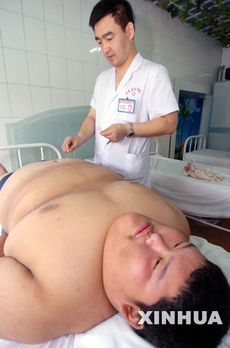 中医减肥 中医减肥