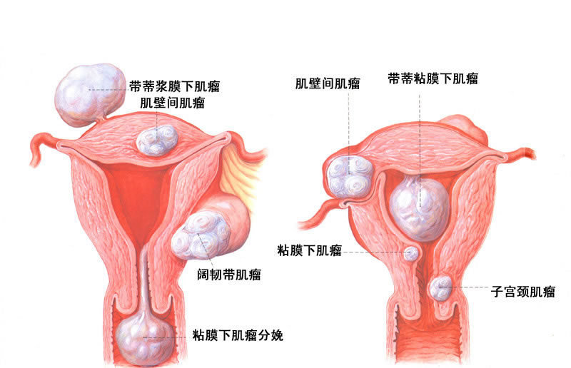 不规则阴道出血