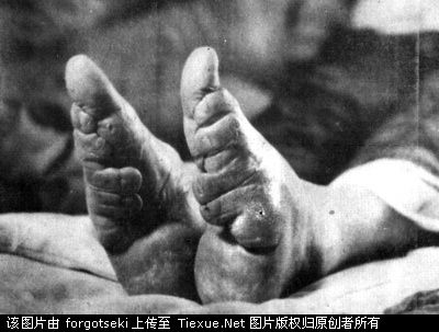 缠足(中国古代一种习俗) 缠足(中国古代一种习俗)